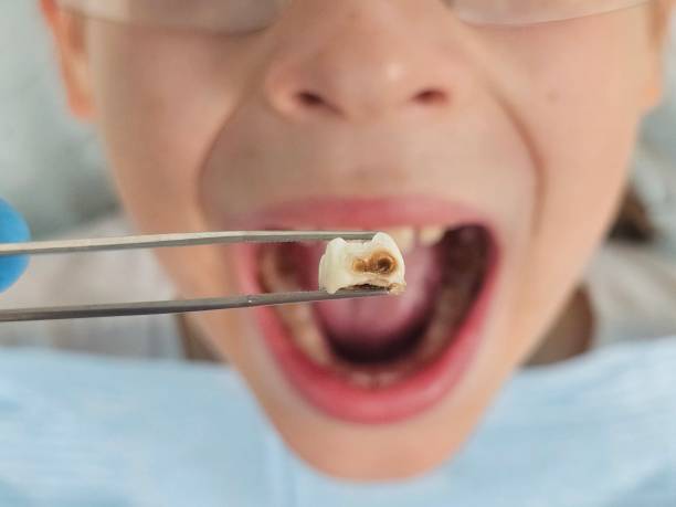 Best Emergency Broken Tooth Repair in Blytheville, AR